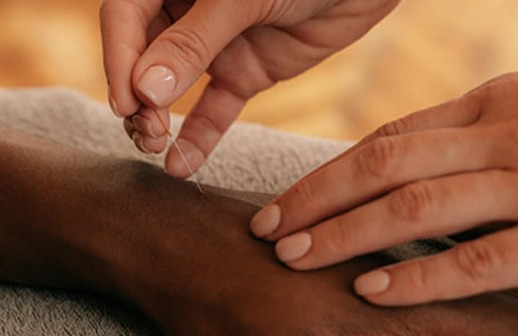 Clinica Samadhi de Acupuntura