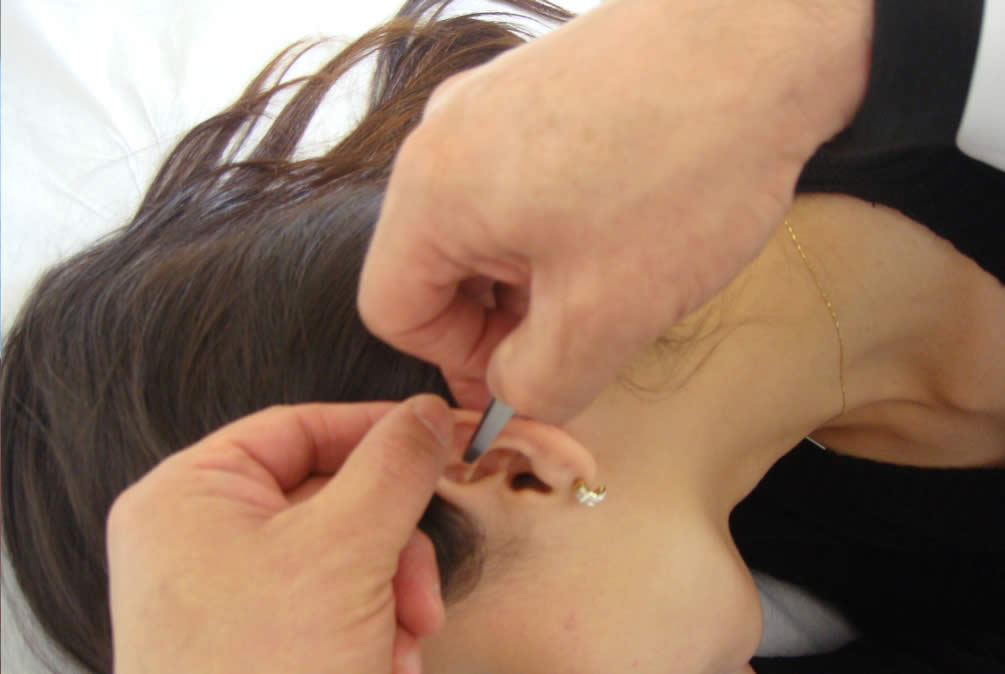 Clinica Samadhi de Acupuntura